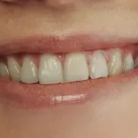 MIZUKIリミテッドショップ